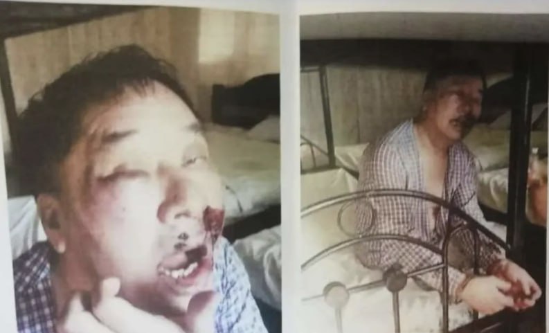 我是70岁的老刘 落地菲律宾遭绑架殴打 死里逃生！