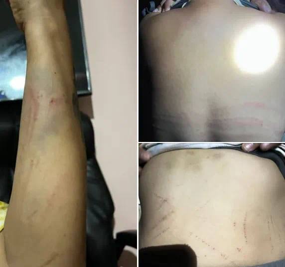 签合同时根本不知情，缅甸27岁女子应聘服务员被骗妓院，逃亡遭电线抽打砍头威胁
